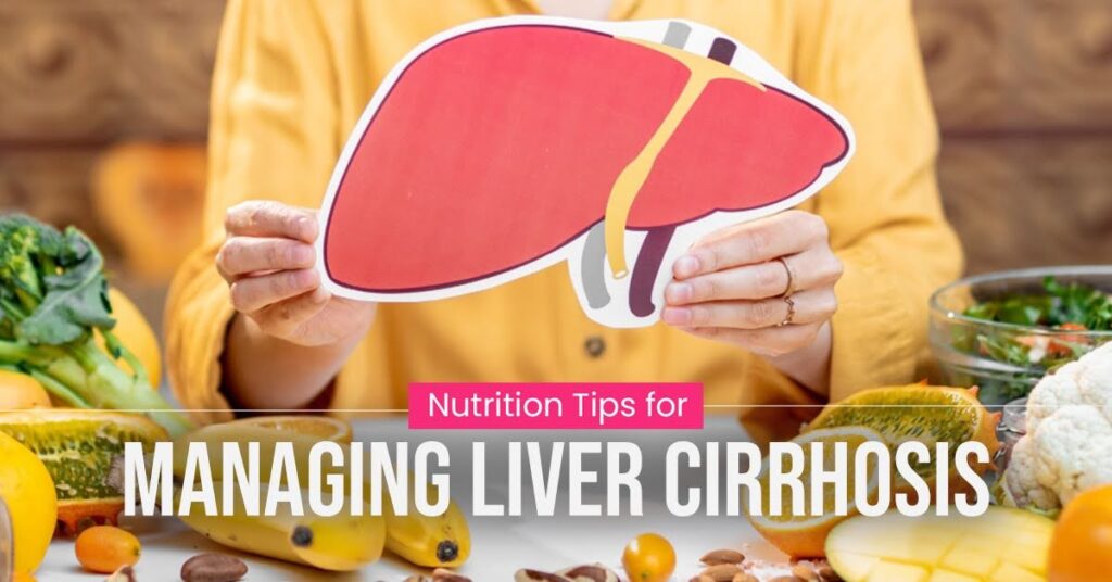 Top Nutrition Tips for Managing Liver Cirrhosis: Foods to Support Your Liver Health